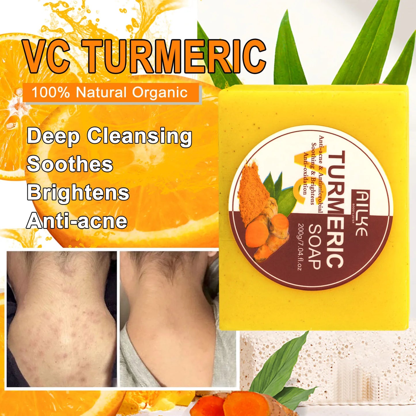 AILKE Natural Turmeric Soap for Face & Body, Lighten, Clean Stains, Brighten Skin Tone, Reduce Acne, Age Spot, Black Spot
