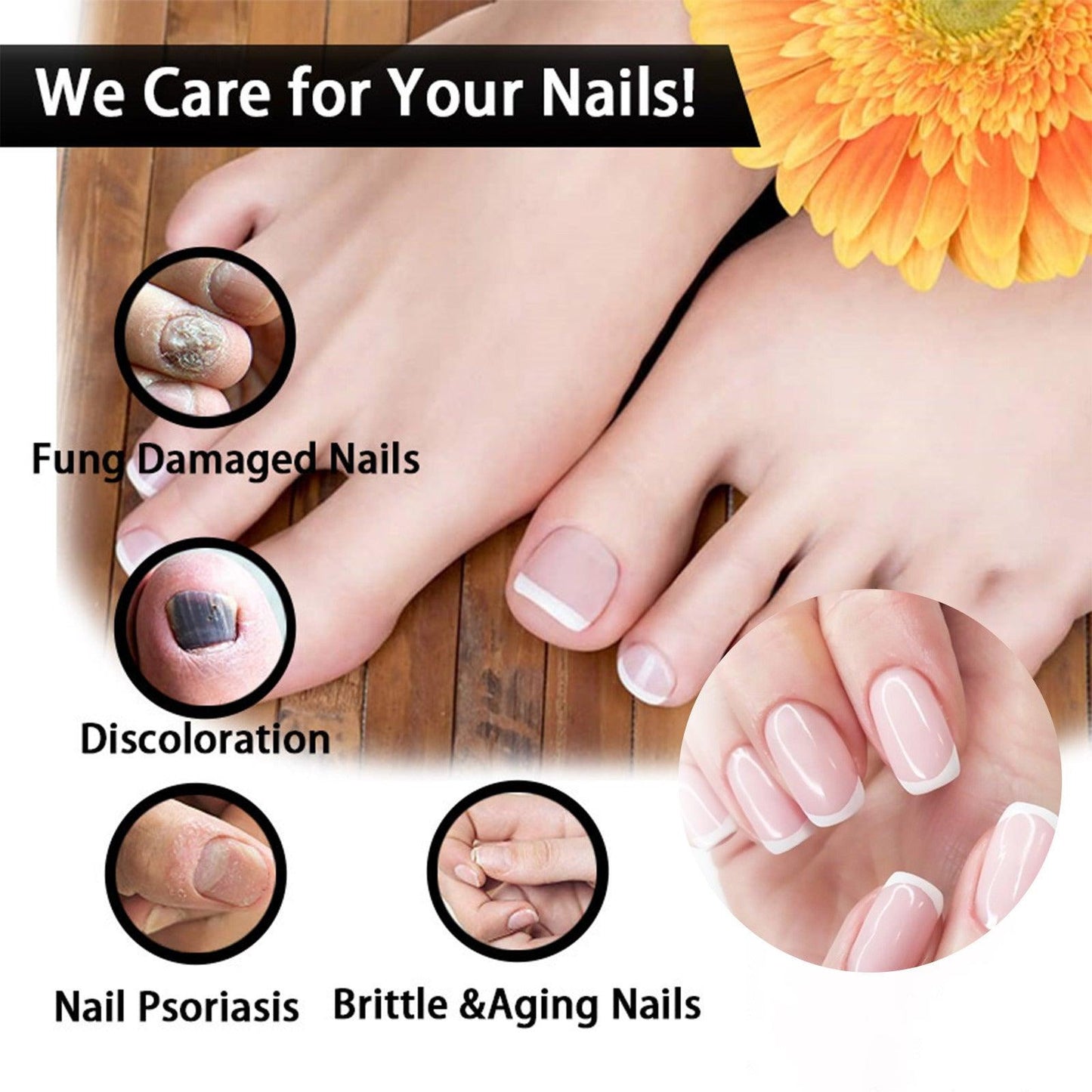 EELHOE Nail Repair Solution, Thickening And Brightening Nails Removing Gray Nail Repair Nourishing Nail Care Solution - Miami beauty1