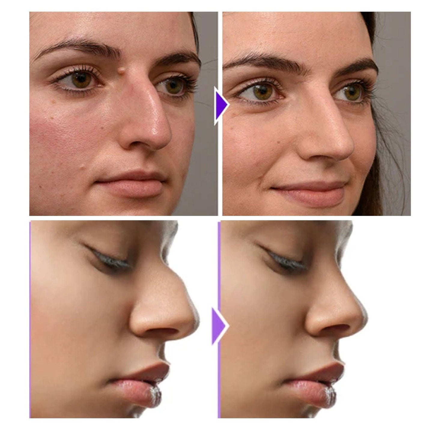 Eelhoe Nose Shaper - Miami beauty1