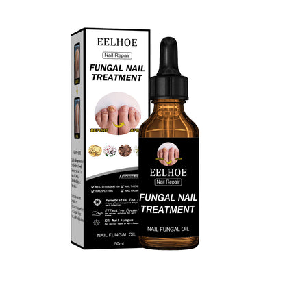 EELHOE Nail Repair Solution, Thickening And Brightening Nails Removing Gray Nail Repair Nourishing Nail Care Solution