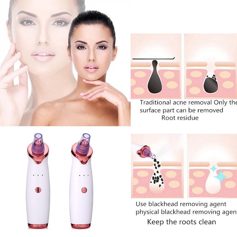 Blackhead Remover Instrument Black Dot Remover Acne Vacuum Suction Face Clean Black Head Pore Cleaning Beauty Skin Care Tool - Miami beauty1