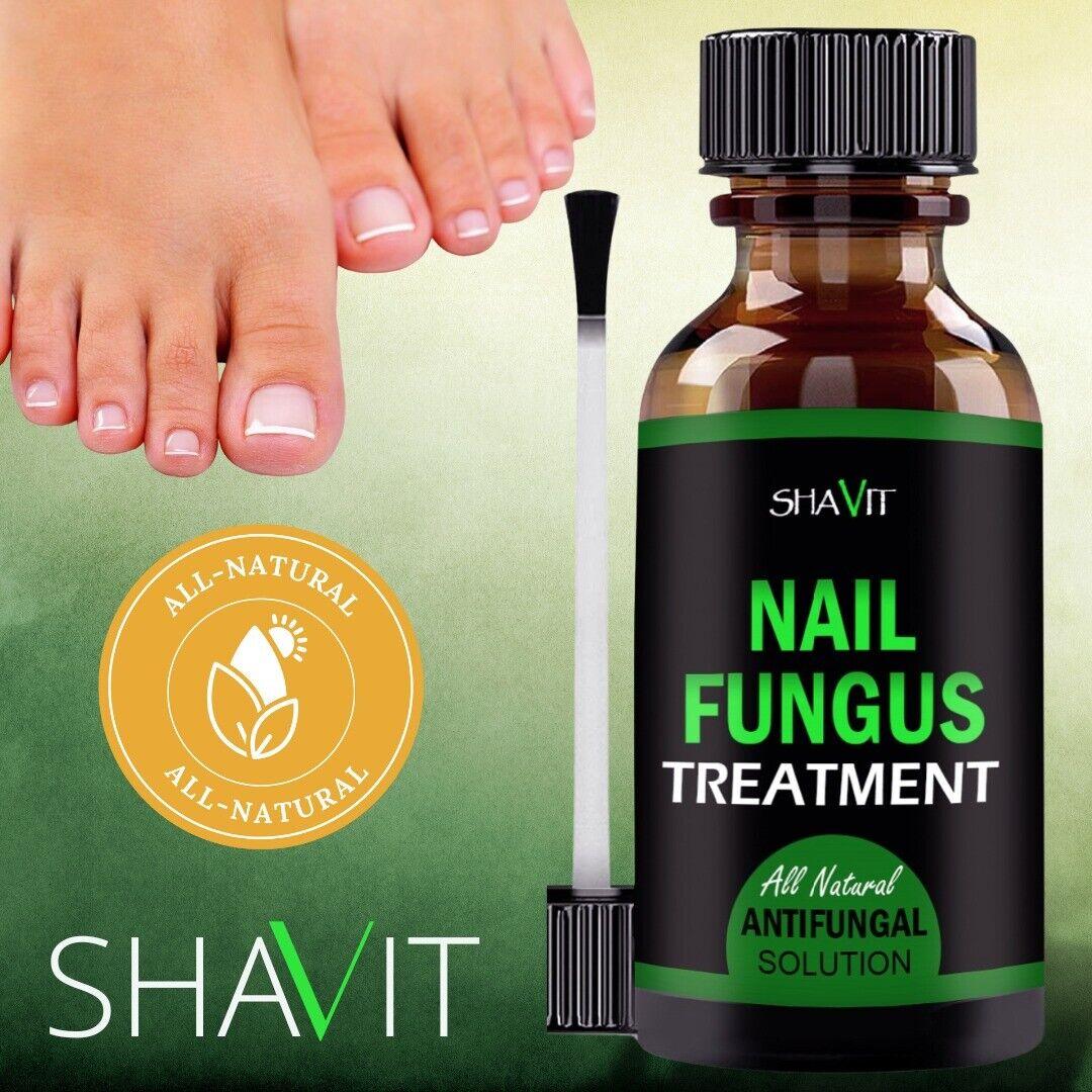 ANTI FUNGAL TREATMENT EXTRA STRENGTH TOENAIL FUNGUS ATHLETES FOOT FUNGI NAIL - Miami beauty1