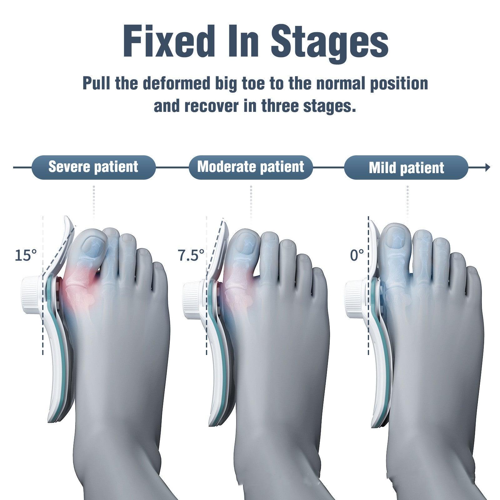 New Men's And Women's 3-board Correction Varying Degrees Thumb Valgus Orthosis - Miami beauty1