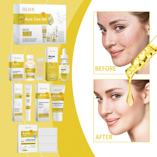 Acne Skin Care Set Skin Care For Acne Skin Is Suitable For Moisturizing And Beautify Soft Skin