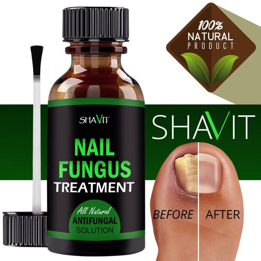 ANTI FUNGAL TREATMENT EXTRA STRENGTH TOENAIL FUNGUS ATHLETES FOOT FUNGI NAIL - Miami beauty1