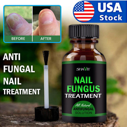 ANTI FUNGAL TREATMENT EXTRA STRENGTH TOENAIL FUNGUS ATHLETES FOOT FUNGI NAIL - Miami beauty1