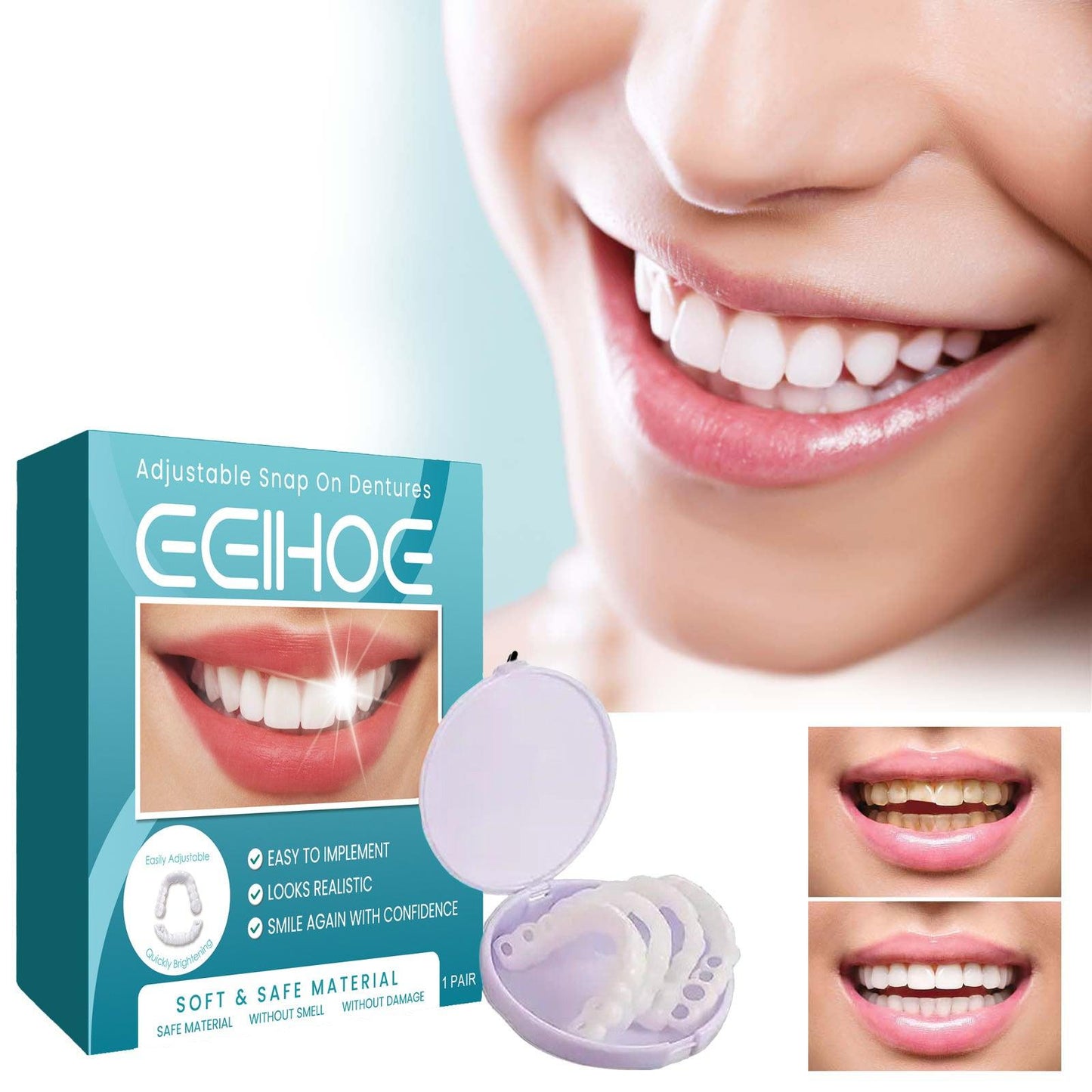 EELHOE Adjustable Buckle Denture, Temporary Fillings Interdental Fillings Orthodontic Denture Kits - Miami beauty1