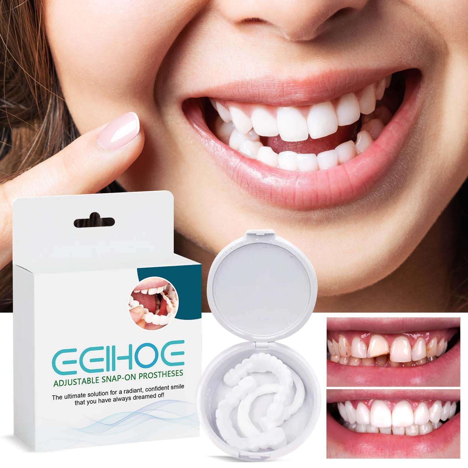 EELHOE Adjustable Buckle Dentures, Modified Teeth Interdental Set Orthodontic Dentures Set - Miami beauty1