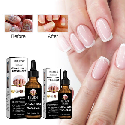 EELHOE Nail Repair Solution, Thickening And Brightening Nails Removing Gray Nail Repair Nourishing Nail Care Solution - Miami beauty1