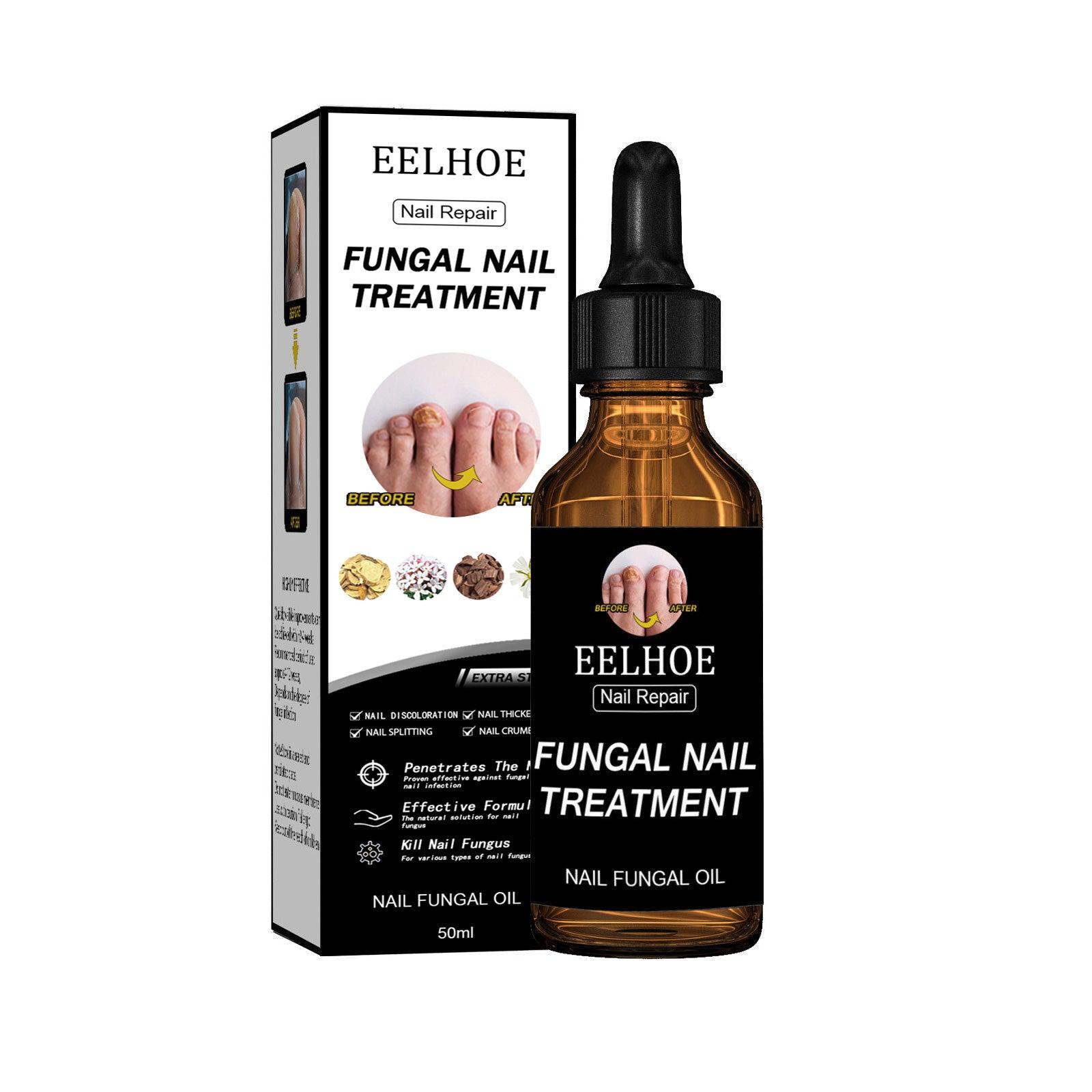 EELHOE Nail Repair Solution, Thickening And Brightening Nails Removing Gray Nail Repair Nourishing Nail Care Solution - Miami beauty1