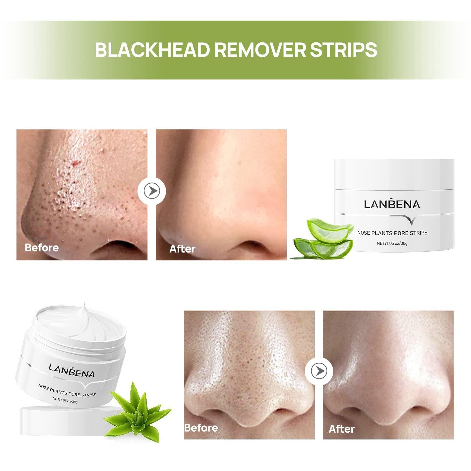 LANBENA Puntos Negros, Blackhead Mask Pore Strips, Deep Cleansing For All Skin Types, Unisex - Miami beauty1
