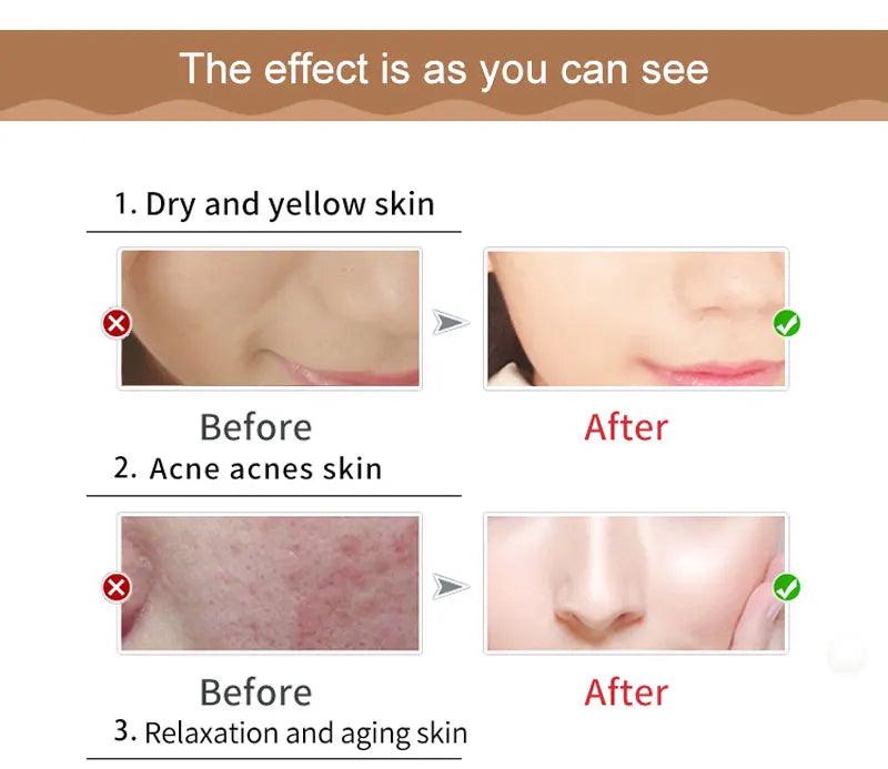 2023 hot sale OEM/ODM Beauty Products Anti Acne Treatment Bentonite Mud Mask Natural Organic Turmeric Face Clay Mask - Miami beauty1