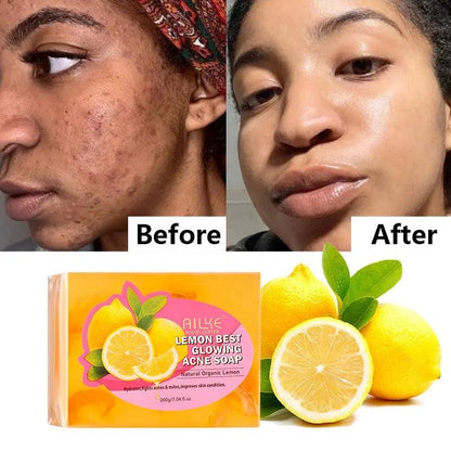 Private Label 200g Organic Alpha Arbutin Skin Glowing Acne Removal Bar Whitening Face Wash Lemon Soap For Black Skin - Miami beauty1