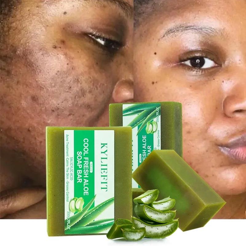 Custom Bathing Soaps Handmade Natural Vegan Cleaning Aloe Vera Face Anti Acne Brightening Bath Soap - Miami beauty1