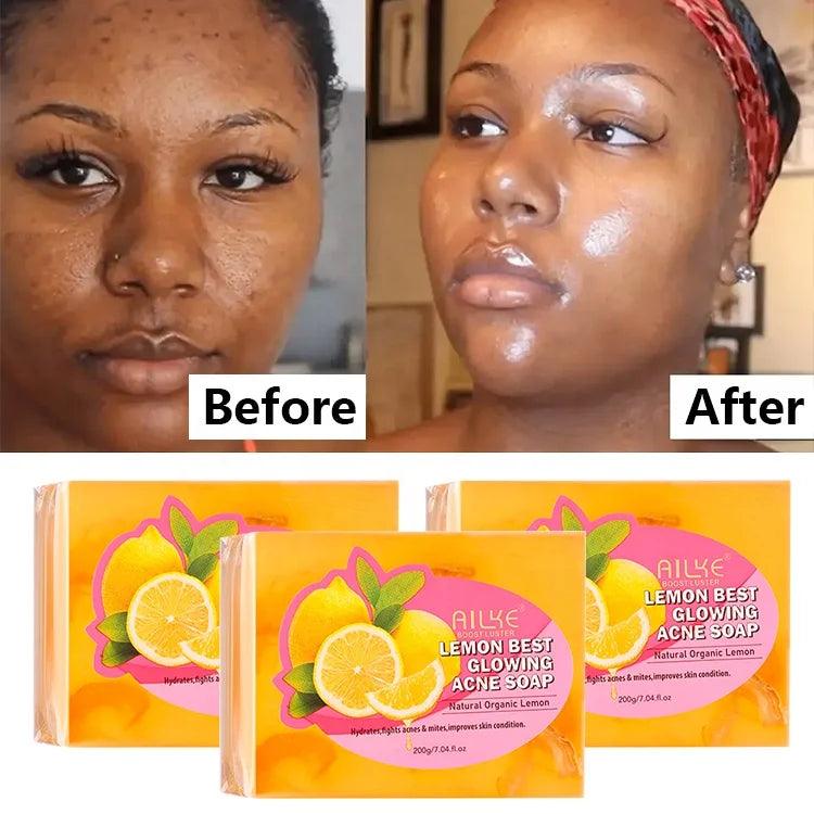 Private Label 200g Organic Alpha Arbutin Skin Glowing Acne Removal Bar Whitening Face Wash Lemon Soap For Black Skin - Miami beauty1