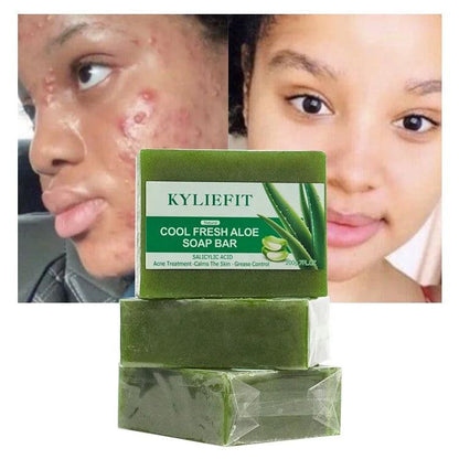 Custom Bathing Soaps Handmade Natural Vegan Cleaning Aloe Vera Face Anti Acne Brightening Bath Soap - Miami beauty1