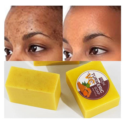 OEM Vegan Face&Body bar Soap Cleansing Remove Dark Spot Removal Turmeric Scrub Acne Treatment Soap - Miami beauty1