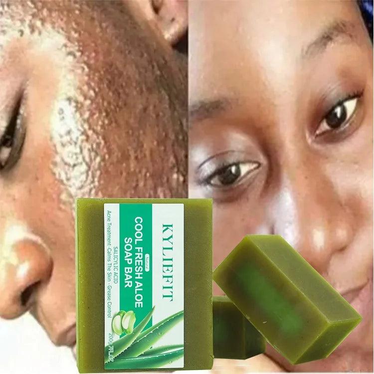 Custom Bathing Soaps Handmade Natural Vegan Cleaning Aloe Vera Face Anti Acne Brightening Bath Soap - Miami beauty1