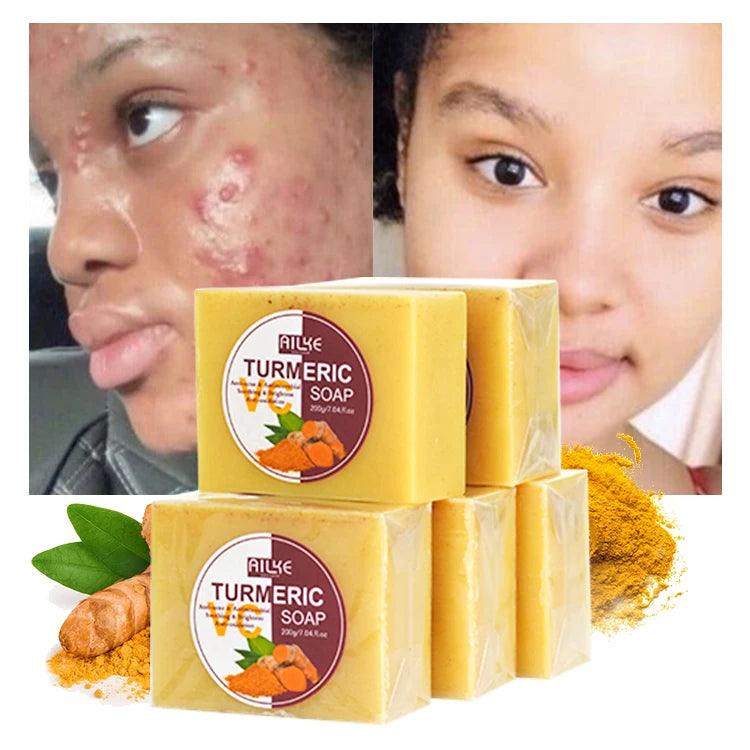 OEM Vegan Face&Body bar Soap Cleansing Remove Dark Spot Removal Turmeric Scrub Acne Treatment Soap - Miami beauty1